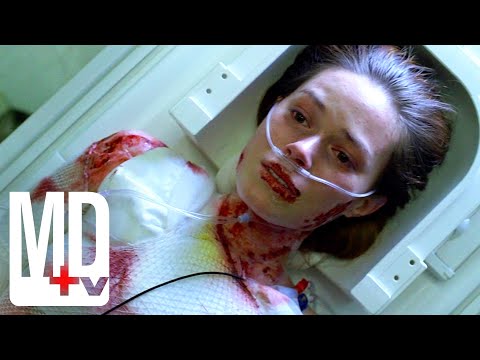 Antibiotics Cause Patient's Skin to Fall Off | House M.D. | MD TV