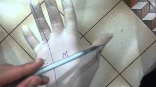 Semio Chirurgicale - Astuce Innervation De La Main - Dr Astuce