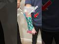 Gips, Der in Sekunden Aushärtet