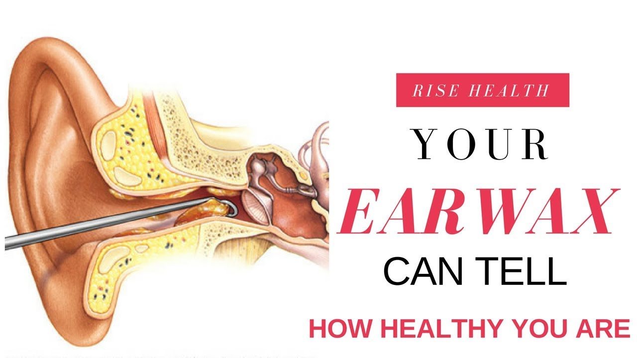 9 color of earwax can says about your health what color ear wax color chart