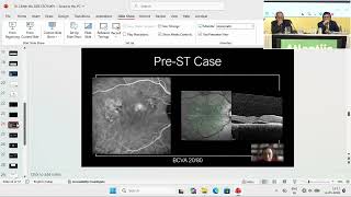 AIOC 2026   GP130   T Dr Lihteh WU Subthreshold Micropulse Laser in CSCR