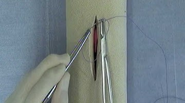 Vertical Mattress Suture Pattern