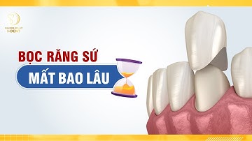 Thời gian bọc sứ mất bao lâu?