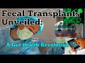 Fecal transplants unveiled transforming gut health