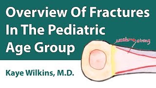 Overview Of Fractures In The Pediatric Age Group