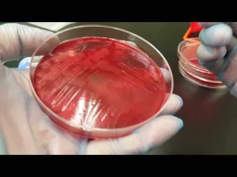 Vídeo: Diarréia Por Clostridium Perfringens Em Cães