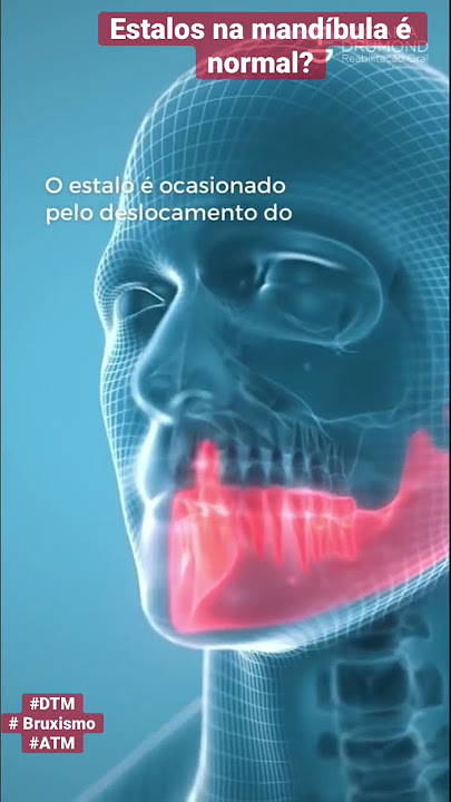 Arquivos mandíbula estalando - VeitSmile