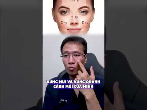 Điều bạn cần