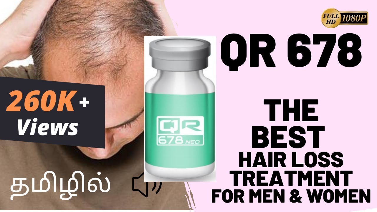 Hair Treatment  What Is QR 678 Hair Transplant  Here Is All You Need To  Know