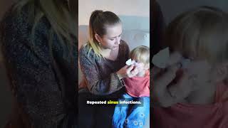 Is Your Childs Snoring Serious Adenoid Adenoidectomy
