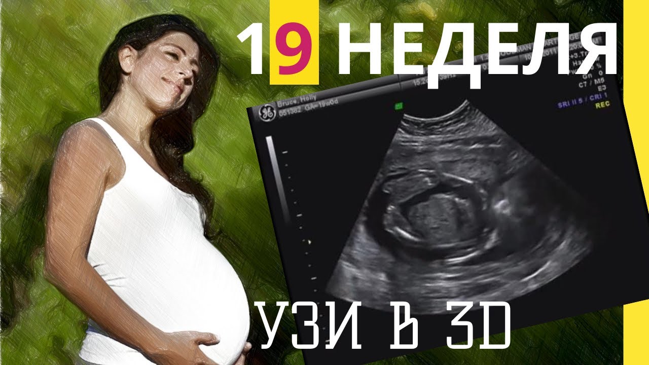 Беременность 19 Недель Развитие Фото
