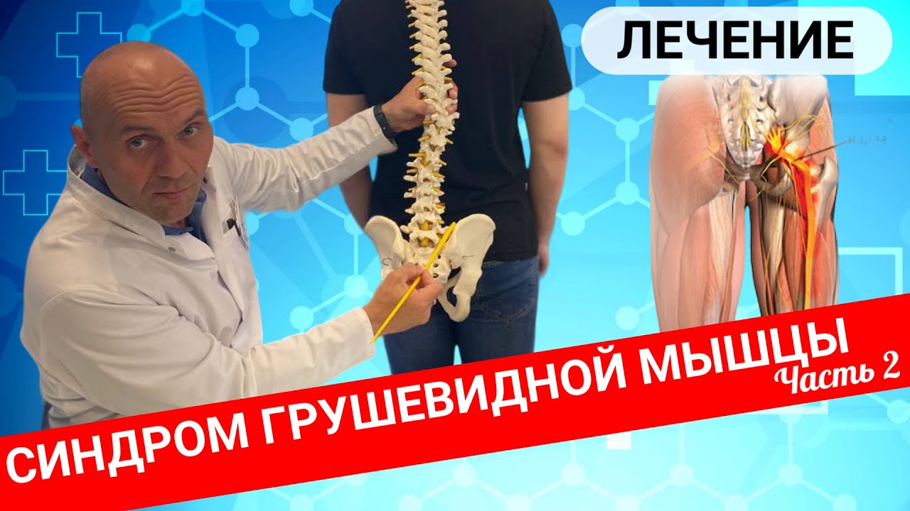 ЛЕЧЕНИЕ БОЛИ В ЯГОДИЦЕ И НОГЕ. Синдром грушевидной мышцы (Часть 2)