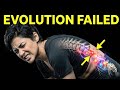 Your Spine Is Slowly Breaking—Here’s Why (3D Analysis)