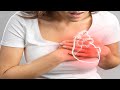 Cardiac Failure: Pathophysiology, Clinical Features & Pharmacology | Mindmap| Episode 36: CVS Series