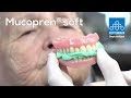 Mucopren® soft - Técnica Directa