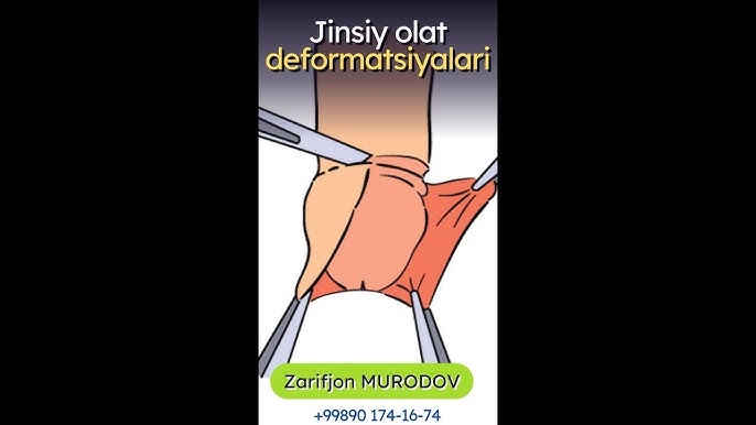 Ayol bilan jinsiy aloqa