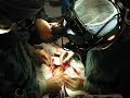 Протезирование Аортального Клапана / Aortic valve replacement