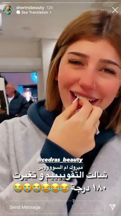 سيدرا بيوتي تضحك لأول مرة بعد ازالة التقويم