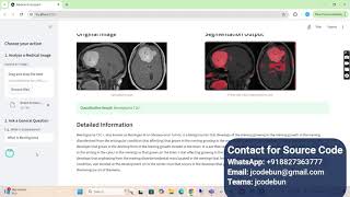 AI-Powered Medical Imaging Chatbot Project Demo | Python, Deep Learning, ResNet, U-Net, RAG
