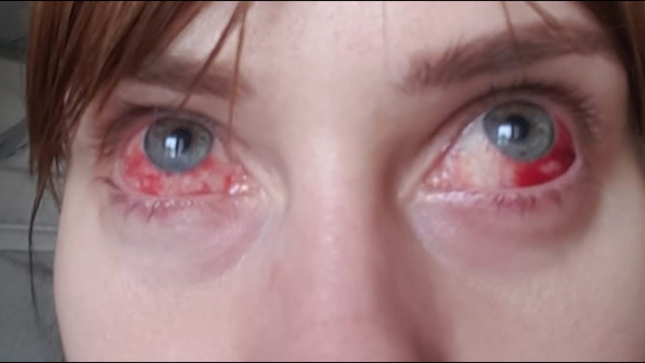 Жертвы ради красоты / Новости