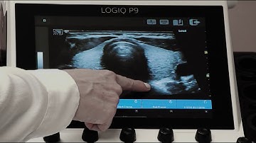 LOGIQ P9 Tutorials: Touchscreen and Trackball