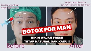 Suntik Botox Before and After for Man (Hasil NYATA ! Bikin Awet Muda) Ovela Clinic