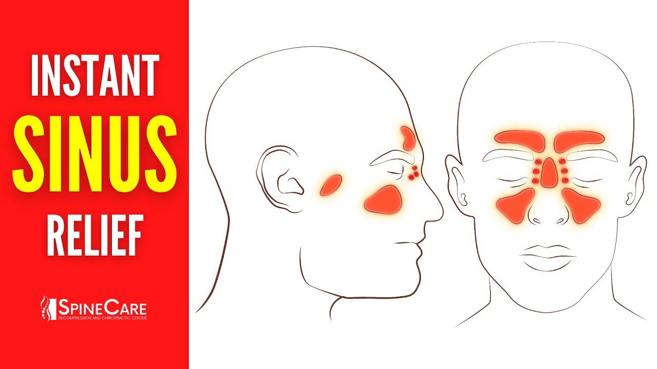 How to Relieve Sinus Congestion in 30 SECONDS 