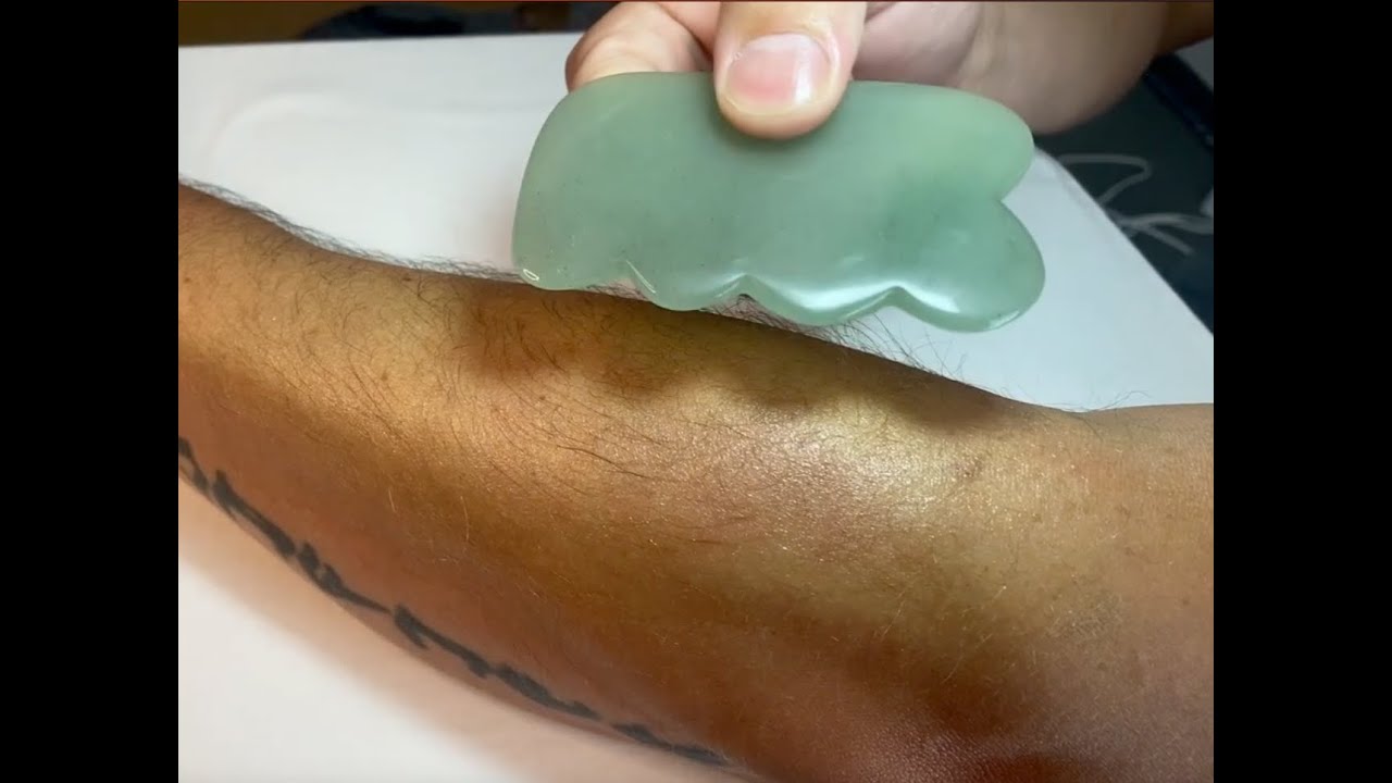 Fix Tennis Elbow with Gua Sha A StepbyStep Guide YouTube