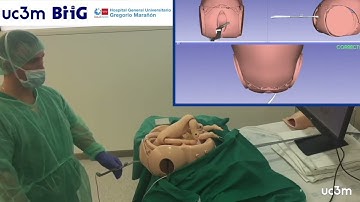 Performance Evaluation to Improve Training in Forceps Assisted Delivery