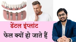 डेंटल इंप्लांट फेल क्यों हो जाते हैं? Success rate of Dental Implant by Dr Ankit Khasgiwala ,Indore