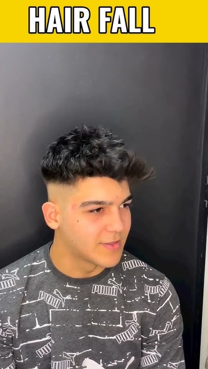 hair-fall-problem-solution-hair-fall-mensfashion-style-youngsigma