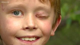 Bailey Boy Attacked By Mountain Lion Speaks With 9News