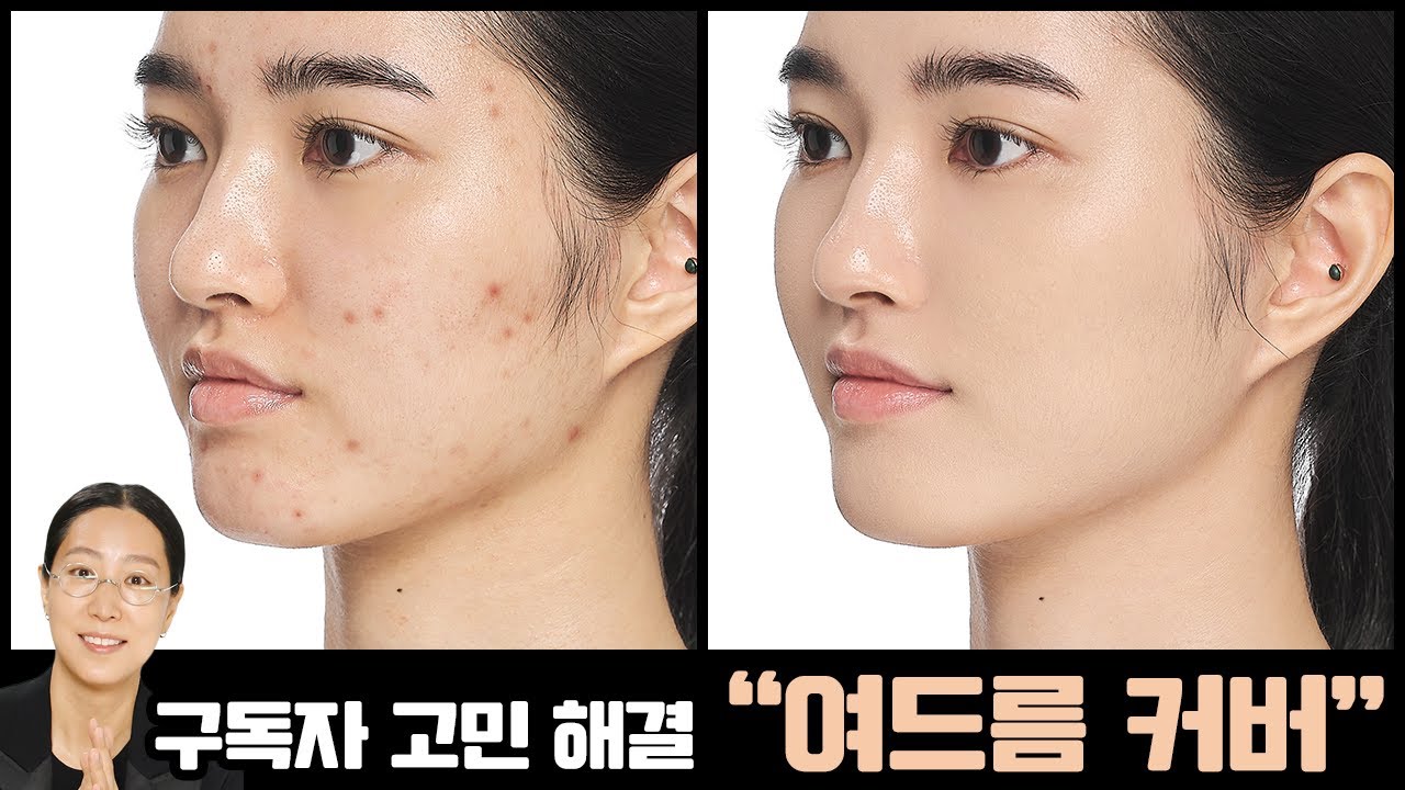 [АНГЛ.] Проблемы подписчиков решены! Легко и идеально замаскируйте шрамы от акне и пигментные пят...