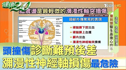 診斷難預後差 頭撞傷以瀰漫性神經軸損傷最危險 健康2.0 - 天天要聞