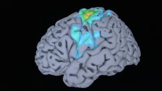 Renée Fleming's Brain Scan: Understanding Music and the Mind