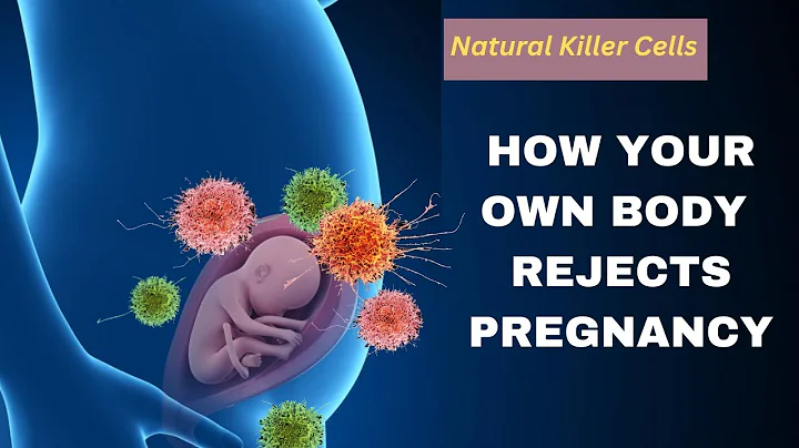 How Your Body's Cells Can Cause Miscarriages | Natural Killer Cells & Pregnancy