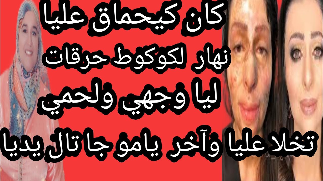 كان كيحماق عليا نهار  لكوكوط حرقات ليا وجهي ولحمي تخلا عليا وآخر يامو جا تال بين يديا ربي كبير