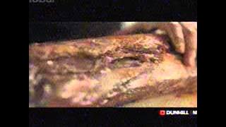 Download lagu Globaltv Dunhill Mild 23 43 (09/03)