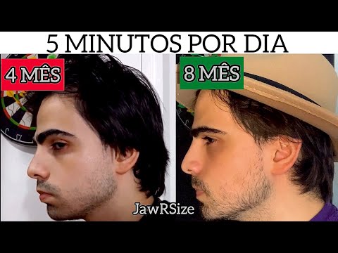 COMO DEFINIR O MAXILAR EM 2 ANOS (JAWRSIZE/ JAW BALL) 