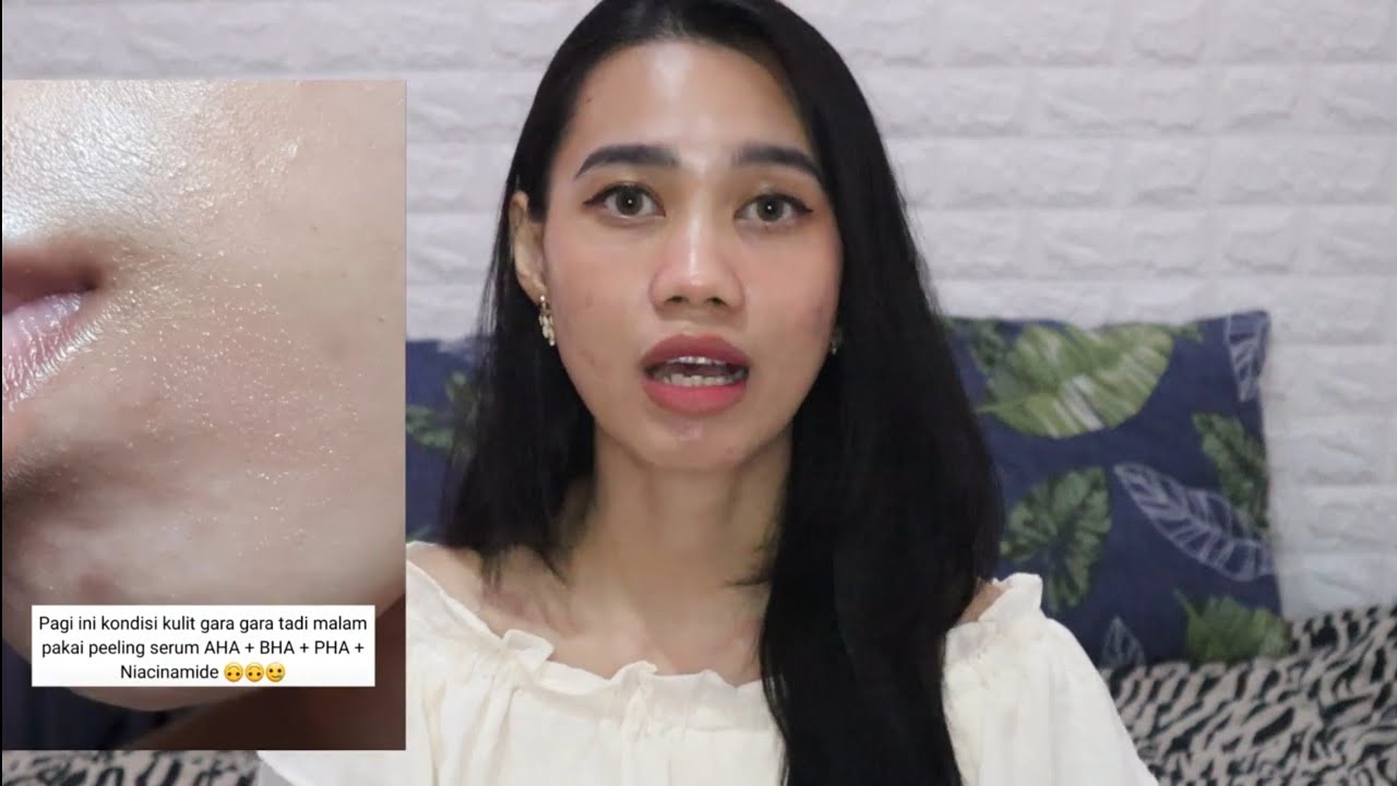 CARA MENGATASI SKIN BARRIER YANG RUSAK - Rekomendasi pelembab untuk