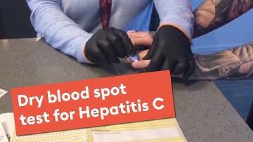 Hep C dry blood spot instruction video Feb 2021