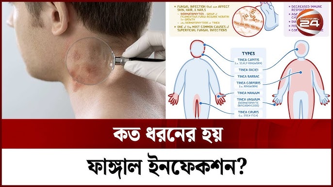 Uz konsert porno Mast rus mushuklarining fotosuratlari