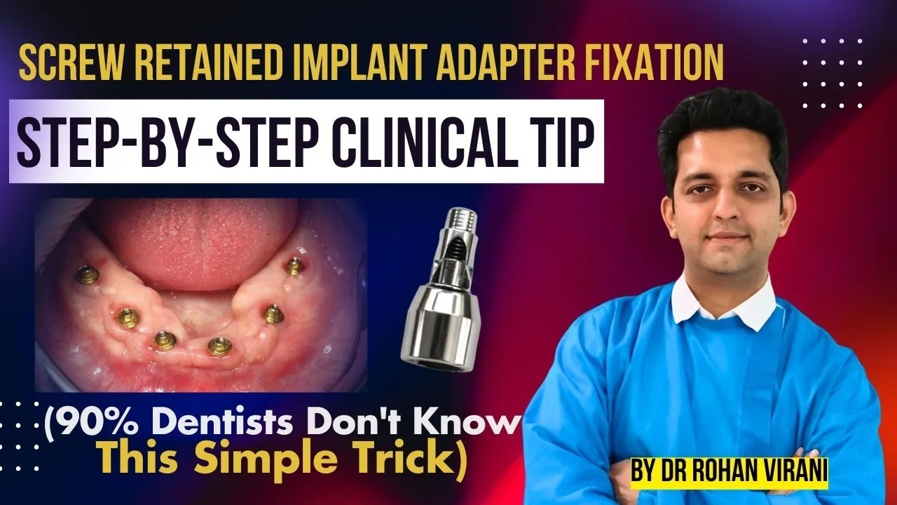 Screw retained BASAL IMPLANTS Adaptor fixation   Step by Step Clinical Tip by dr rohan virani