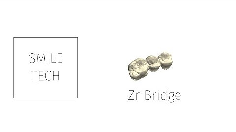 3shape Zirconium Bridge Design.
