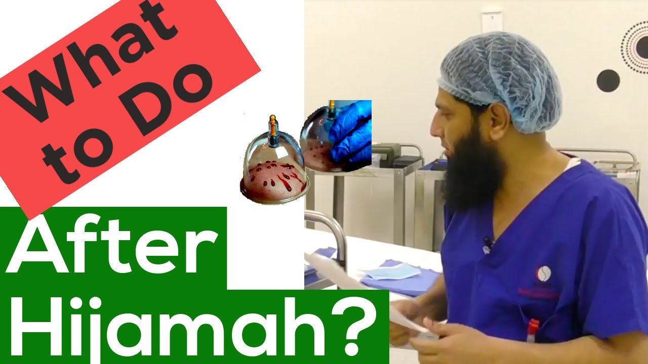 What To Do After Cupping Therapy, Hijamah (Precautions) In English By Dr. Iftikhar Ahmad