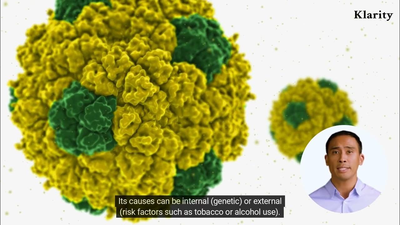 What Is Hard Palate Cancer? YouTube