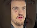 MINI MIKE OPOWIADA CO SIĘ DZIAŁO W SZPITALU #shorts