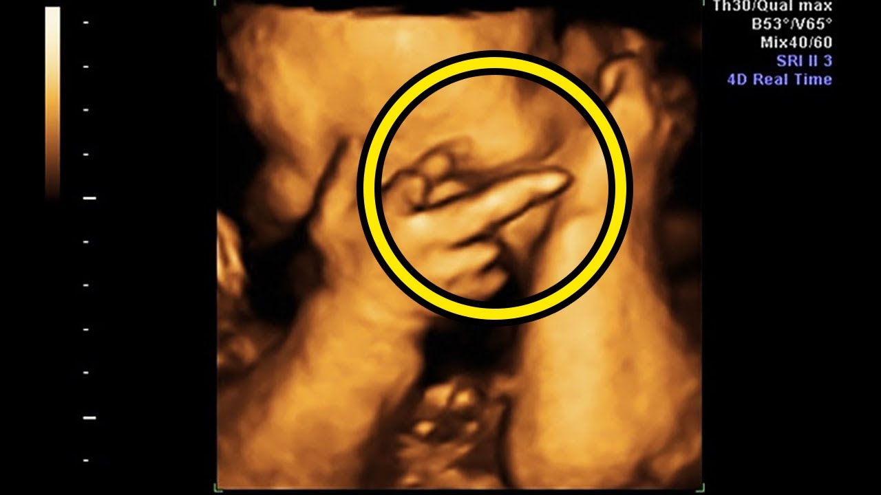 Mom Thinks She's Pregnant With Twins, Doctor Freezes When He Sees Her  Ultrasound - YouTube