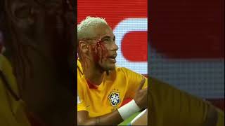 Neymar’s Injury #shorts #fyp #viral #foryou #soccer #tiktok #capcut #messi #sub#yt#worldcup#views