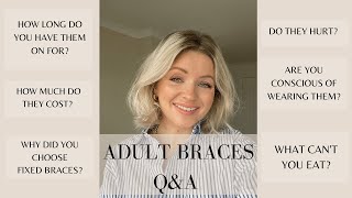 FIXED ADULT BRACES Q&A / CERAMIC BRACES / LAURA BYRNES